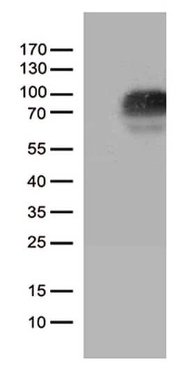 CSF2RA Monoclonal Antibody (OTI2E12), TrueMAB , OriGene 100 &mu;L | Buy Online | OriGene | Fisher Scientific