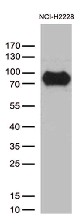 CSF2RA Monoclonal Antibody (OTI2E12), TrueMAB , OriGene 100 &mu;L | Buy Online | OriGene | Fisher Scientific
