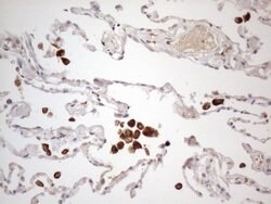 CSF2RB Monoclonal Antibody (OTI1G5), TrueMAB , OriGene 100 &mu;L; Unconjugated:Antibodies,