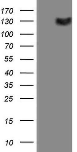 CSF2RB Monoclonal Antibody (OTI7A4), TrueMAB , OriGene 100 &mu;L; Unconjugated:Antibodies,