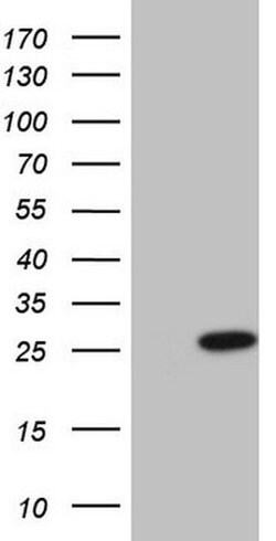 CSF3 Monoclonal Antibody (OTI4H9), TrueMAB , OriGene:Antibodies:Primary