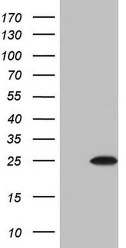 CSF3 Monoclonal Antibody (OTI7B3), TrueMAB , OriGene:Antibodies:Primary