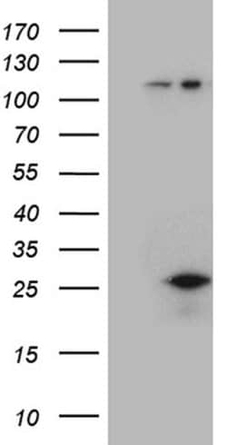 CSF3 Monoclonal Antibody (OTI1C7), TrueMAB , OriGene 100 &mu;L; Unconjugated:Antibodies,