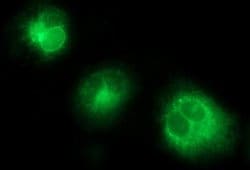 CSH1 Monoclonal Antibody (OTI3G5), TrueMAB , OriGene:Antibodies:Primary