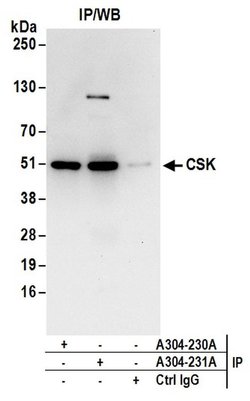 CSK Rabbit anti-Human, Polyclonal, Bethyl Laboratories 10 &mu;L | Buy Online | Bethyl Laboratories, Inc | Fisher Scientific