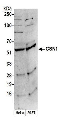 CSN1 Polyclonal Antibody, Bethyl Laboratories:Antibodies:Primary Antibodies