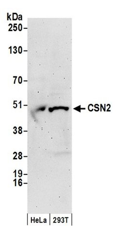 CSN2 Rabbit anti-Human, Mouse, Polyclonal, Bethyl Laboratories 100 &mu;L;