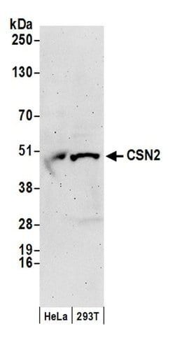 CSN2 Polyclonal Antibody, Bethyl Laboratories 20 &mu;L; Unconjugated:Antibodies,