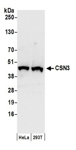 CSN3 Rabbit anti-Human, Polyclonal, Bethyl Laboratories 100 &mu;l; Unlabeled:Antibodies,