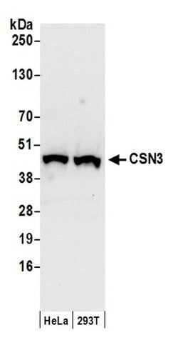 CSN3 Polyclonal Antibody, Bethyl Laboratories:Antibodies:Primary Antibodies