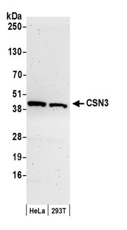 CSN3 Rabbit anti-Human, Polyclonal, Bethyl Laboratories 100 &mu;L; Unconjugated:Antibodies,