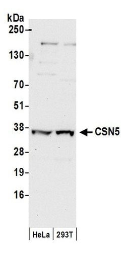CSN5 Polyclonal Antibody, Bethyl Laboratories 20 &mu;L; Unconjugated:Antibodies,