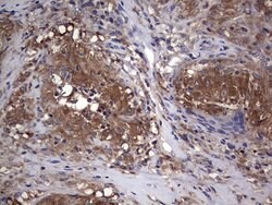 CSNK1E Monoclonal Antibody (OTI5H10), TrueMAB , OriGene 100 &mu;L | Buy Online | Origene Technologies | Fisher Scientific