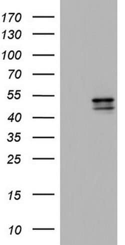CSNK1E Monoclonal Antibody (OTI2B3), TrueMAB , OriGene 100 &mu;L; Unconjugated:Antibodies,