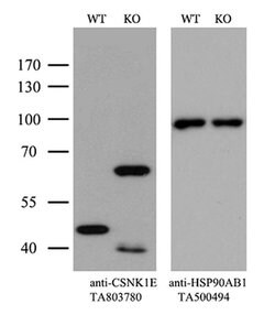 CSNK1E Monoclonal Antibody (OTI2B3), TrueMAB , OriGene 100 &mu;L; Unconjugated:Antibodies,