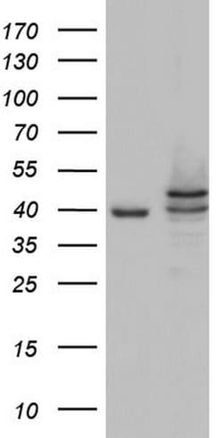 CSNK1E Mouse anti-Human, Clone: OTI5D4, TrueMAB , Origene 30 &mu;L; Unconjugated:Antibodies,