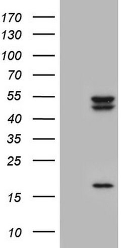 CSNK1E Monoclonal Antibody (OTI5H10), TrueMAB , OriGene 100 &mu;L | Buy Online | Origene Technologies | Fisher Scientific
