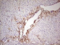 CSNK1G1 Mouse anti-Human, Clone: OTI1C5, lyophilized, TrueMAB 100 &mu;g;