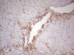 CSNK1G1 Monoclonal Antibody (OTI1C5), TrueMAB , OriGene 100 &mu;L; Unconjugated:Antibodies,