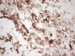 CSNK1G1 Mouse anti-Human, Clone: OTI1C5, lyophilized, TrueMAB 100 &mu;g;