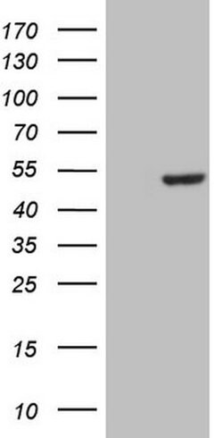 CSNK1G1 Mouse anti-Human, Clone: OTI1C5, lyophilized, TrueMAB 100 &mu;g;