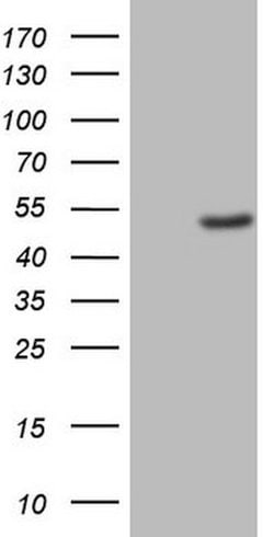 CSNK1G1 Mouse anti-Human, Clone: OTI1D7, lyophilized, TrueMAB 100 &mu;g;