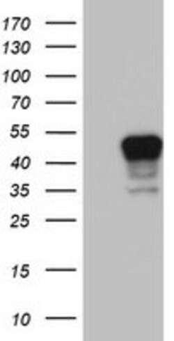 CSNK1G2 Mouse anti-Human, Clone: OTI1H6, lyophilized, TrueMAB 100 &mu;g;