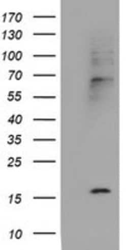 CST2 Mouse anti-Human, Clone: OTI1D6, lyophilized, TrueMAB 100 &mu;g; Unconjugated:Antibodies,