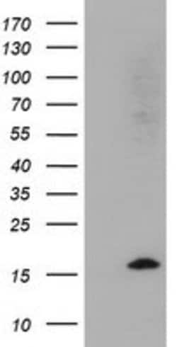 CST2 Mouse anti-Human, Clone: OTI5C2, lyophilized, TrueMAB 100 &mu;g; Unconjugated:Antibodies,