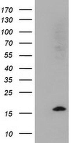 CST2 Monoclonal Antibody (OTI5C2), TrueMAB , OriGene 30 &mu;L | Buy Online | OriGene | Fisher Scientific