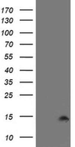 CST2 Monoclonal Antibody (OTI2D6), TrueMAB , OriGene 100 &mu;L; Unconjugated:Antibodies,