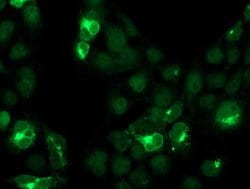 CST4 Mouse anti-Human, Clone: OTI2H10, lyophilized, TrueMAB 100 &mu;g;