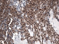 CSTB Monoclonal Antibody (OTI2A7), TrueMAB , OriGene:Antibodies:Primary