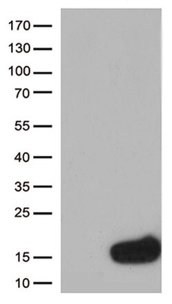 CSTB Monoclonal Antibody (OTI1F12), TrueMAB , OriGene 100 &mu;L; Unconjugated:Antibodies,