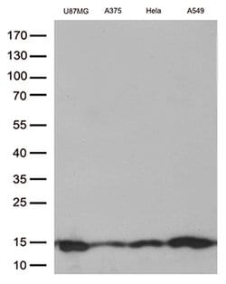 CSTB Monoclonal Antibody (OTI1F12), TrueMAB , OriGene 100 &mu;L; Unconjugated:Antibodies,