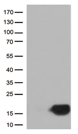 CSTB Monoclonal Antibody (OTI2A7), TrueMAB , OriGene:Antibodies:Primary