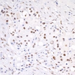 CSTF64 Rabbit anti-Human, Polyclonal, Bethyl Laboratories 100 &mu;L; Unconjugated:Antibodies,