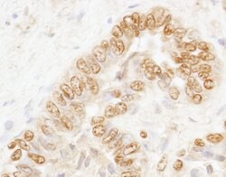 CSTF77 Rabbit anti-Human, Polyclonal, Bethyl Laboratories 100 &mu;l; Unlabeled:Antibodies,