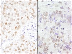 CSTF77 Rabbit anti-Human, Mouse, Polyclonal, Bethyl Laboratories 100 &mu;L;