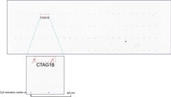 CTAG1B Mouse anti-Human, Clone: UMAB73, liquid, UltraMAB 100 &mu;L | Buy Online | Origene Technologies | Fisher Scientific