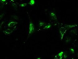 CTAG1B Mouse anti-Human, Clone: OTI3C9, liquid, TrueMAB 100 &mu;L; Unconjugated:Antibodies,