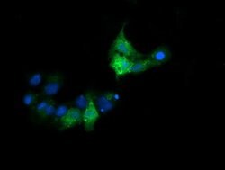 CTAG1B Mouse anti-Human, Clone: OTI2A10, lyophilized, TrueMAB 100 &mu;g;