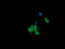 CTAG1B Mouse anti-Human, Clone: OTI2G2, lyophilized, TrueMAB 100 &mu;g;