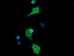 CTAG1B Mouse anti-Human, Clone: OTI2B4, lyophilized, TrueMAB 100 &mu;g;