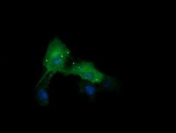 CTAG1B Monoclonal Antibody (OTI1C4), TrueMAB , OriGene:Antibodies:Primary