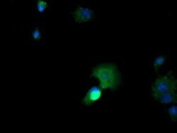 CTAG1B Monoclonal Antibody (OTI5H4), TrueMAB , OriGene 100 &mu;L; Unconjugated:Antibodies,