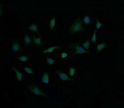 CTAG1B Monoclonal Antibody (OTI4C12), TrueMAB , OriGene 100 &mu;L; Unconjugated:Antibodies,
