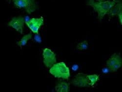 CTAG1B Monoclonal Antibody (OTI5E1), TrueMAB , OriGene 100 &mu;L; Unconjugated:Antibodies,