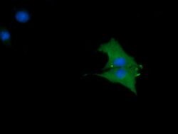 CTAG1B Mouse anti-Human, Clone: OTI9H6, lyophilized, TrueMAB 100 &mu;g;