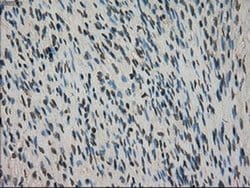CTAG1B Mouse anti-Human, Clone: OTI3C9, liquid, TrueMAB 100 &mu;L; Unconjugated:Antibodies,